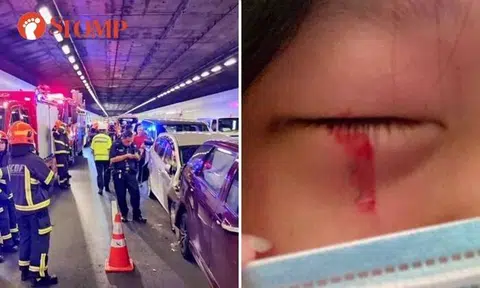 9-vehicle chain collision in KPE tunnel: Mother and daughter taken to hospital