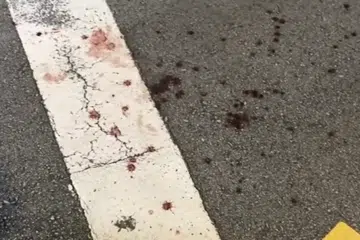 Woman's middle finger nearly detached after bloody Tanjong Pagar altercation