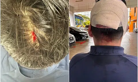 12-year-old boy allegedly hit classmate's head with bottle