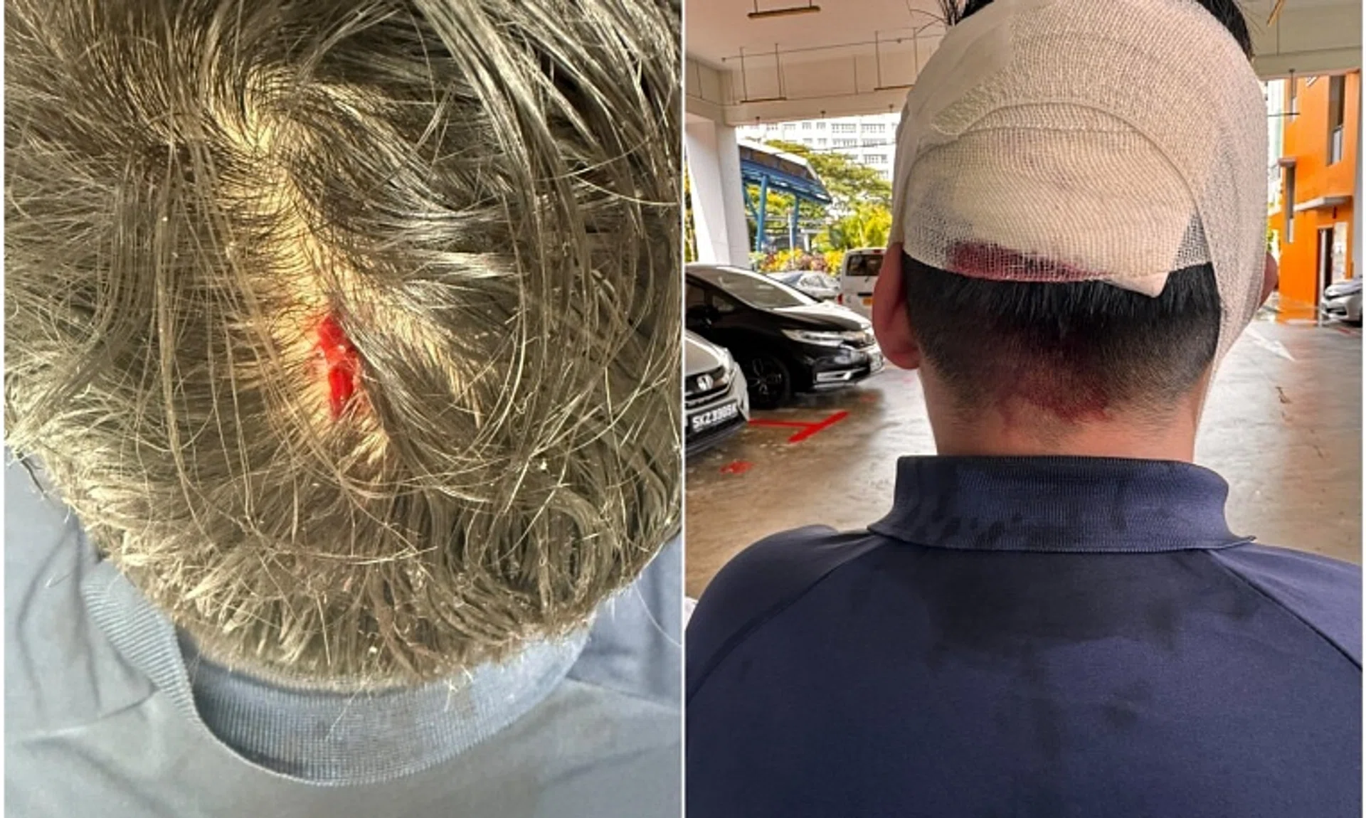 The school, Admiralty Secondary, said it is aware of the incident, which resulted in a cut on the victim’s head. 