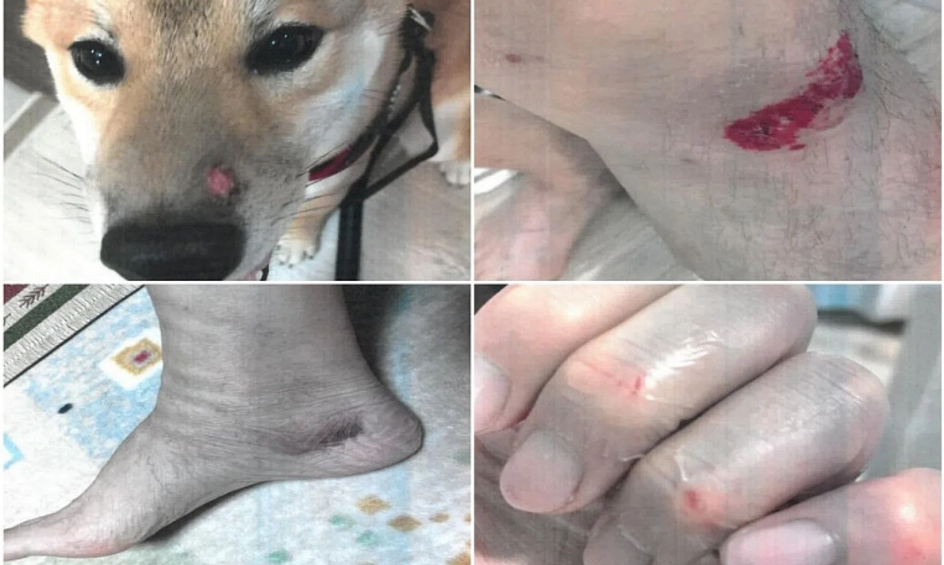 Ng Boon Siong's bull terrier attacked a dog belonging to a member of the public, resulting in the latter two sustaining injuries.