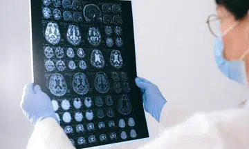 First child cured of rare brain tumour 'offers real hope'