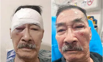 Security officer, 80, assaulted by man he spotted sleeping on public bench