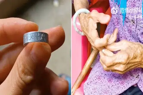 Woman in China wore chicken leg band for years thinking it was a 'silver ring'
