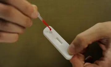 HIV disclosure law to be amended