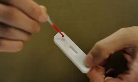 HIV disclosure law to be amended
