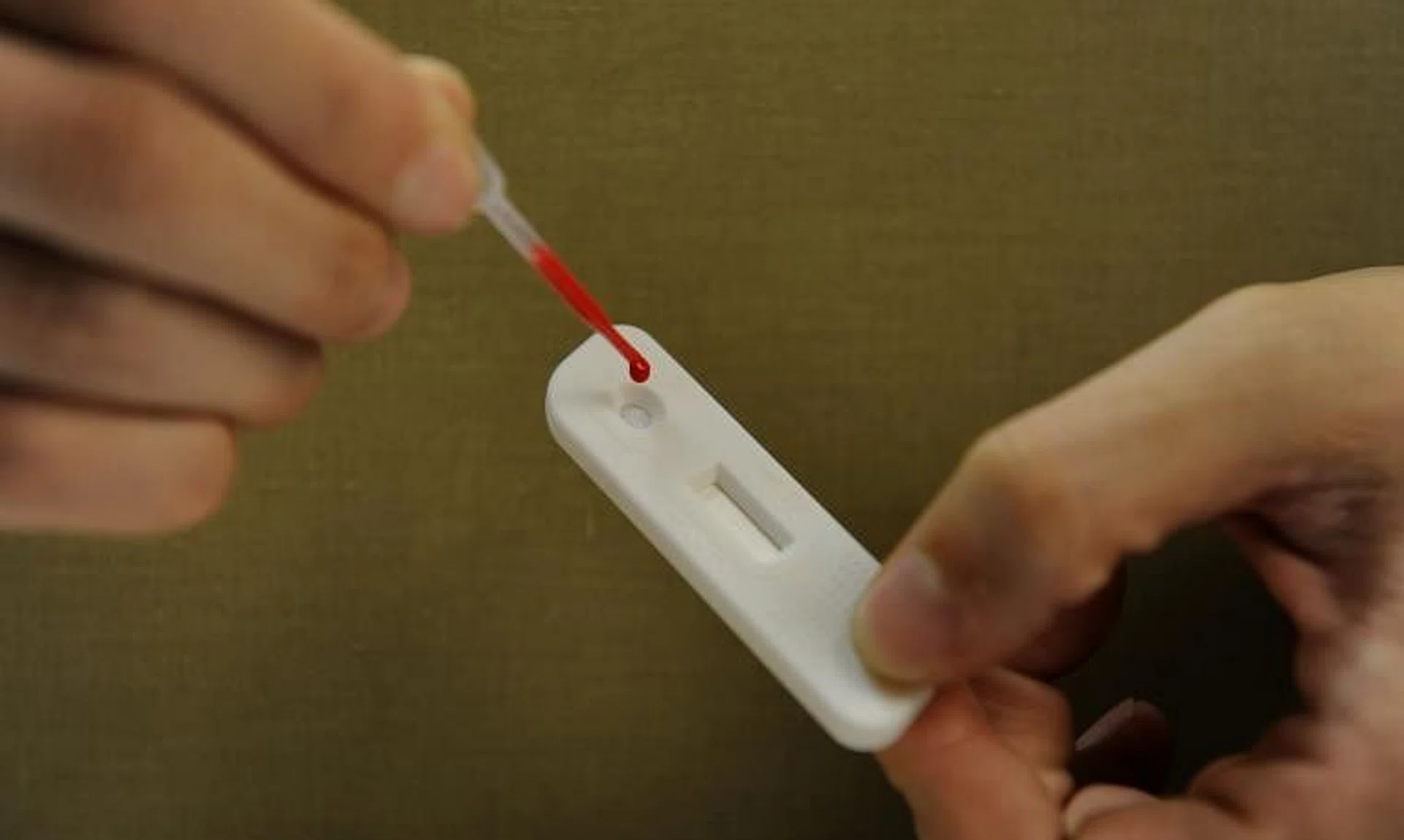 Those living with HIV are urged to adhere to treatment and monitor their viral load closely with their doctors to reduce the risk of transmission.