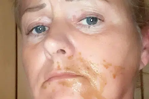 615