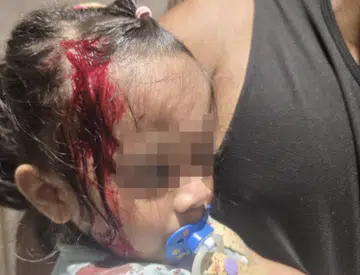 Metal hook falls from height, hurts toddler at Sengkang playground