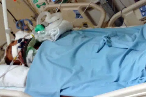 Biker couple injured in mystery accident: They still don't know who hit them