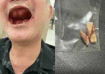 Man, 71, loses teeth after fight with couple over baby stroller in Tampines One lift