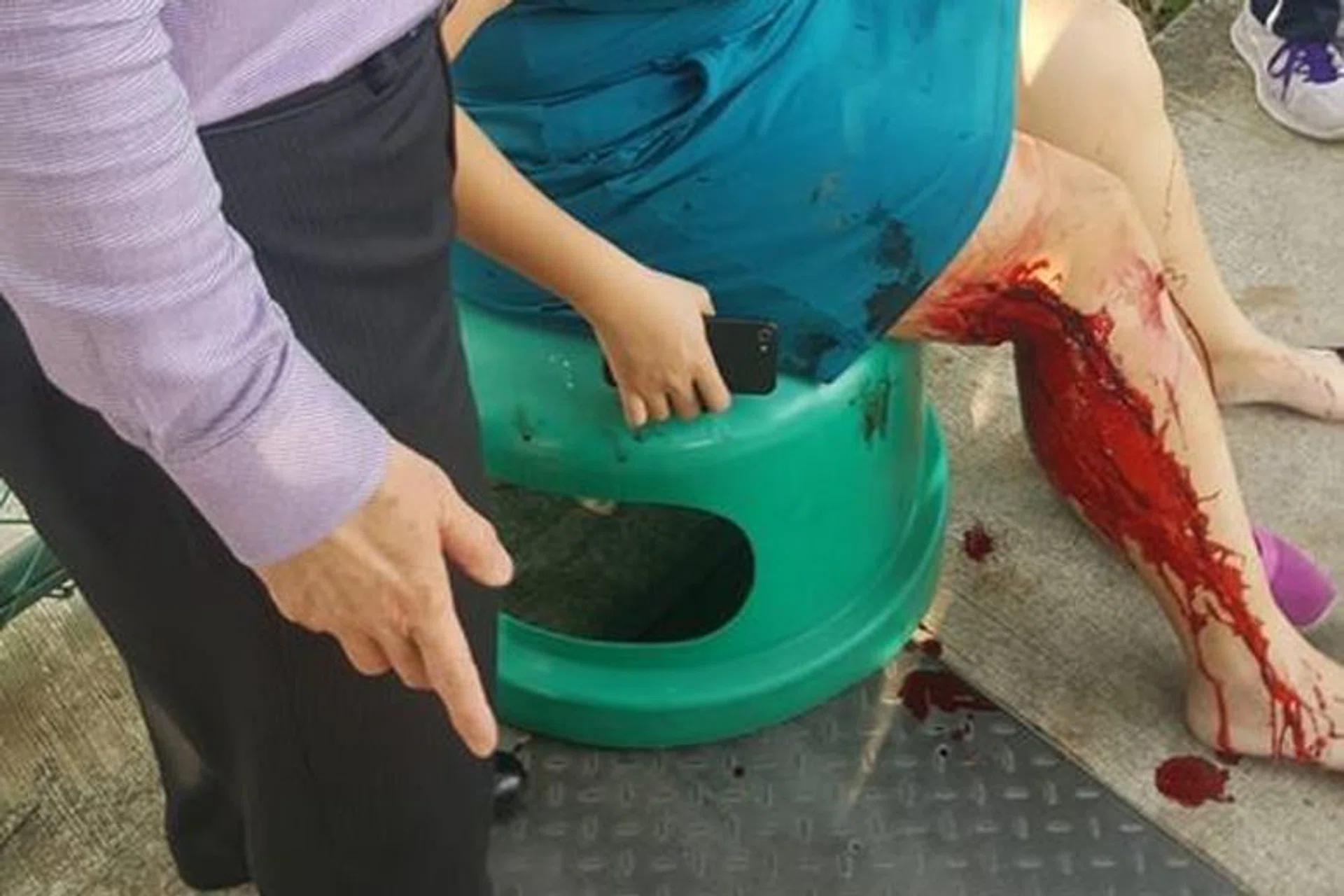 Above: The woman had deep cuts on her right calf after the attack by the wild boar, which was trapped in the bin centre at the Waterbay executive condominium. 