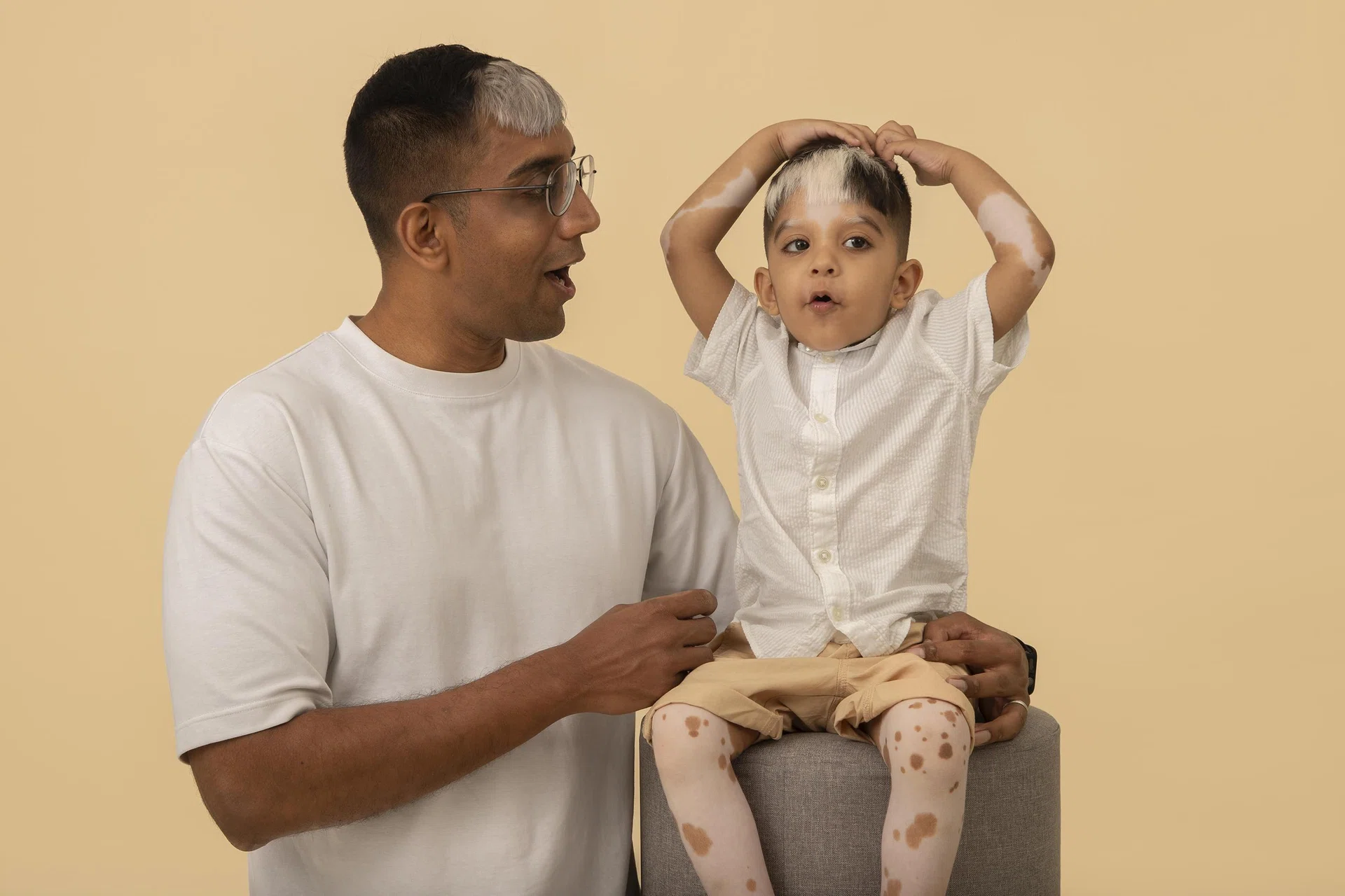Mr Azharuddin Mohamed Naseem bleached his forelock white to look like his son, Mohamed Zain, who has piebaldism.