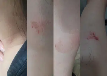 Woman bruised when JB-Expo bus driver closed doors on her