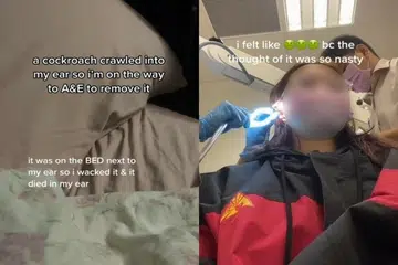 Cockroach crawls into woman's ear, breaks in pieces as she tries to dislodge it