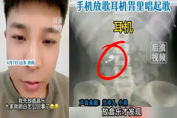 Man in China falls asleep with earphones on, wakes up with one end inside belly