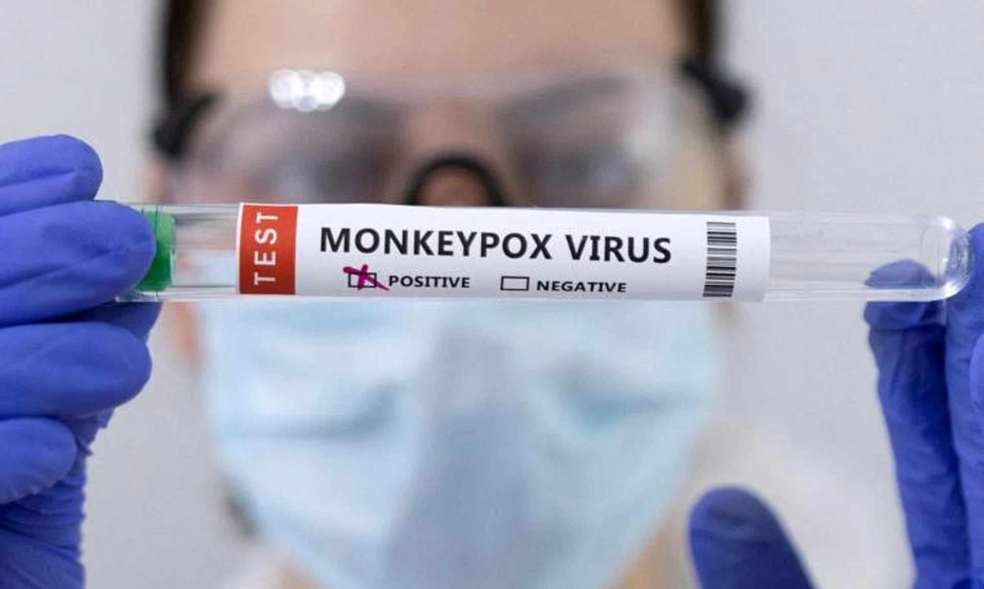 The first female case of monkeypox in Denmark was reported on Aug 19.