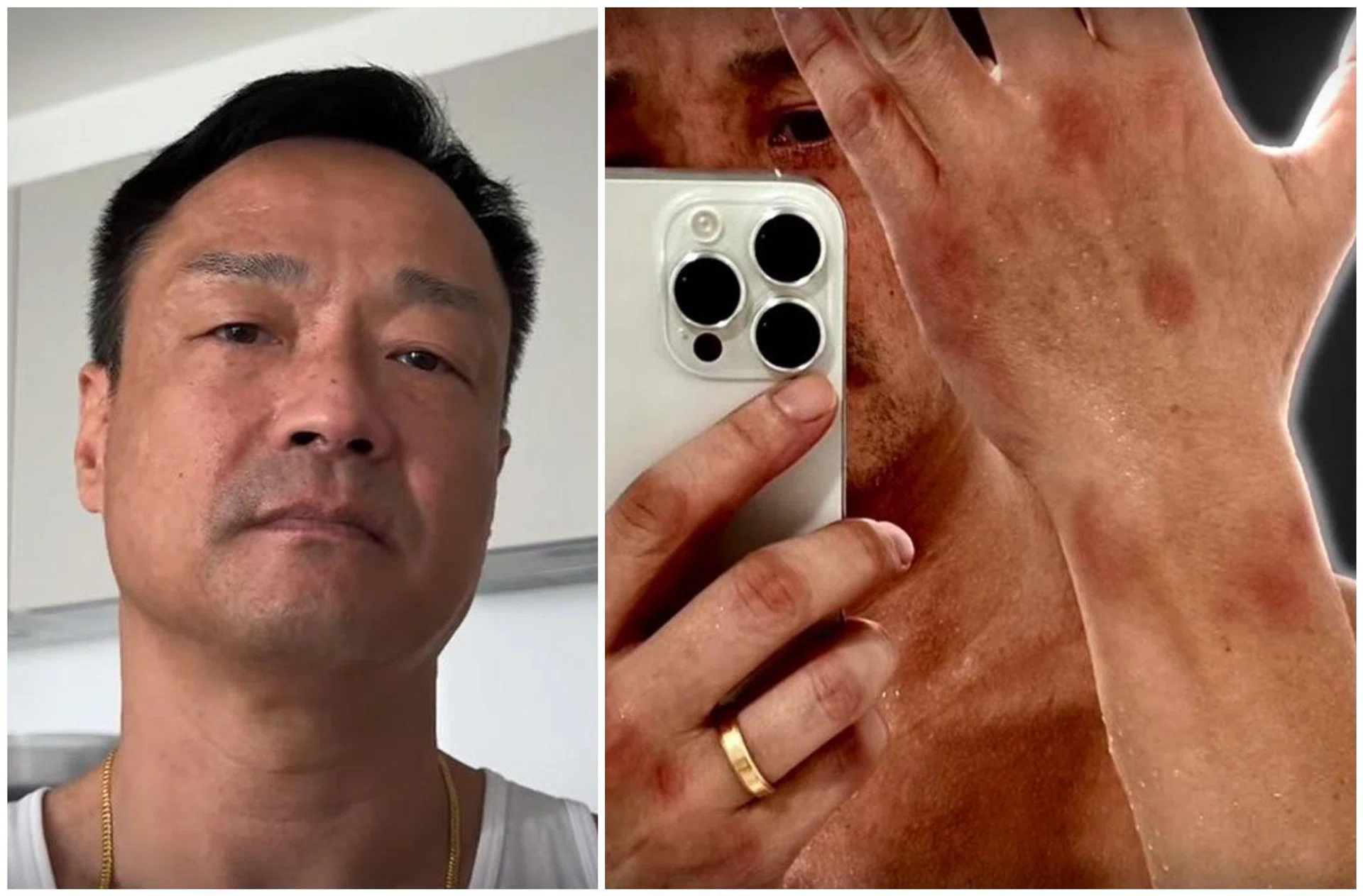 Wong He said his kidney failure might be linked to two suspected sexual assaults that took place in Taiwan in 2024.