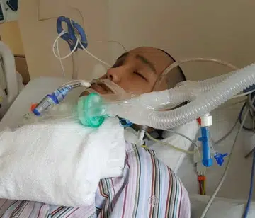Motorcyclist in coma after tree falls on him