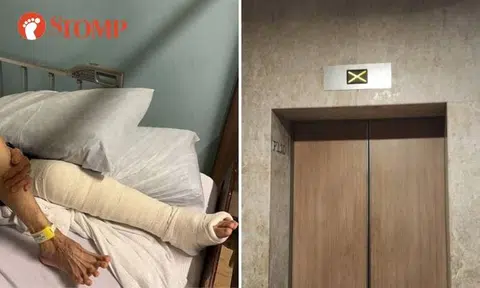 Condo resident with leg injury can't go for medical due to lifts constantly not working