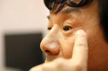 Bus driver who lost eye in attack: 'I'll never forgive him'