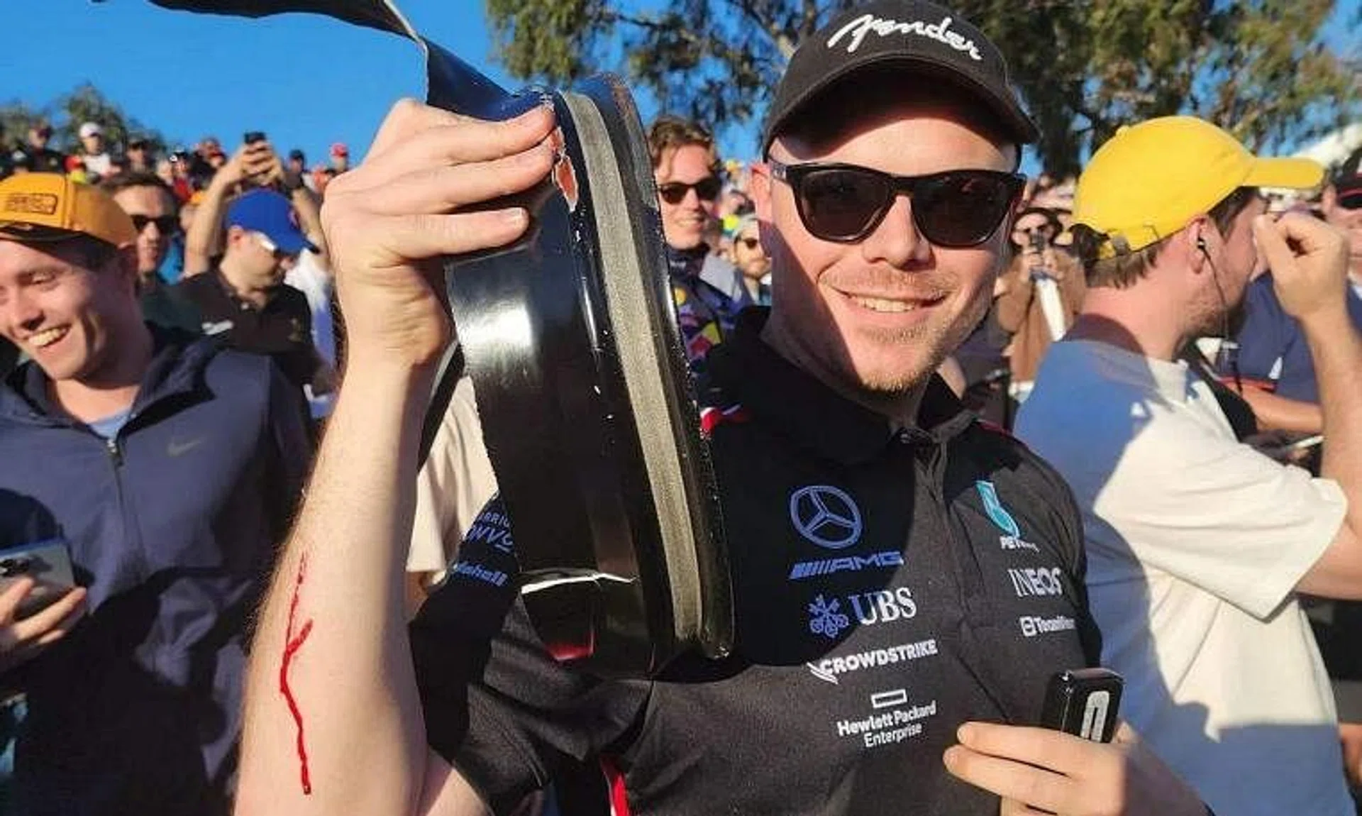 Formula One fan Will Sweet was hit by a piece of debris that flew out from the track after Haas driver Kevin Magnussen crashed during the Australian Grand Prix.