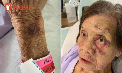 Woman, 83, falls on her face in toilet of transitional care facility
