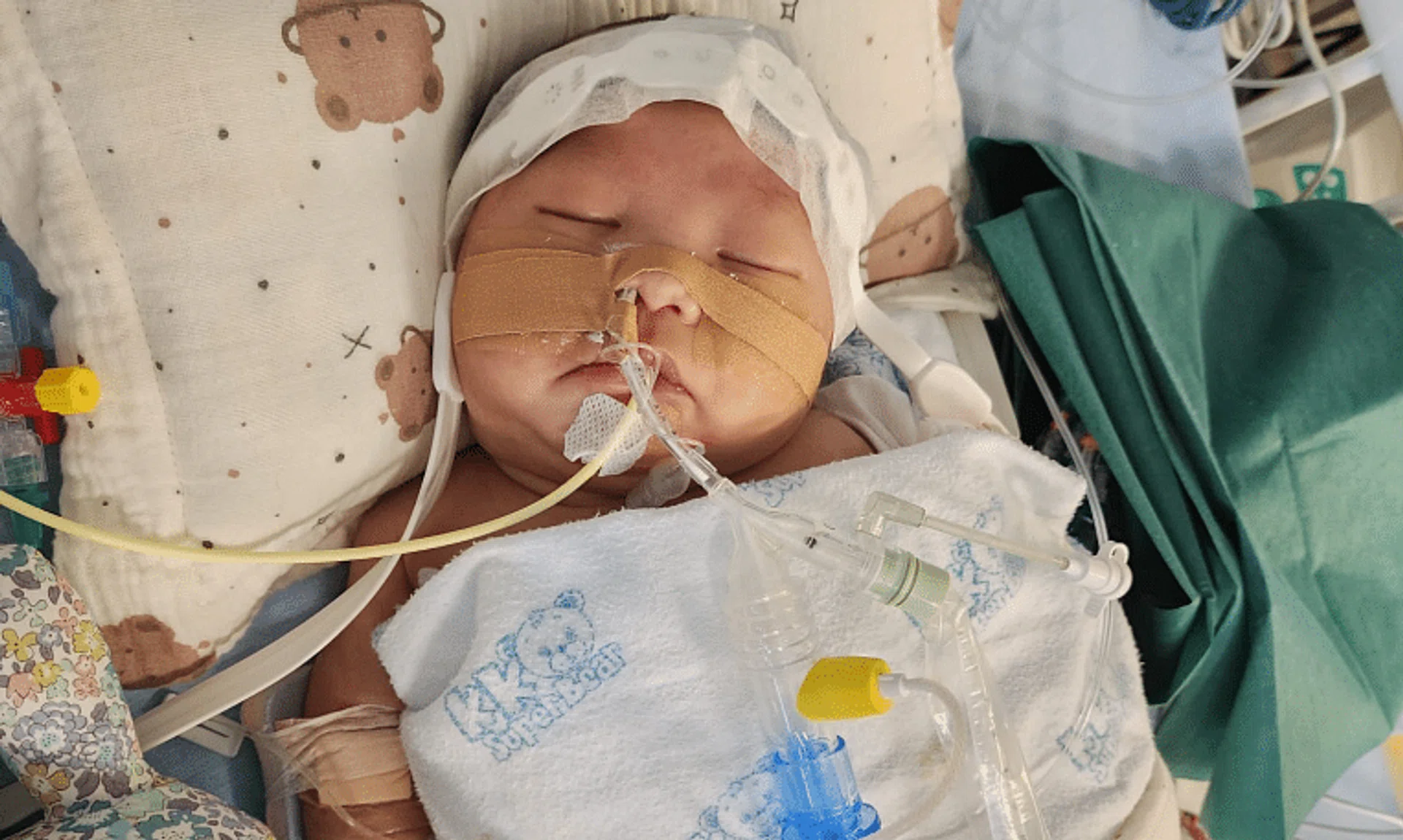 Born with pulmonary atresia, Leon Koit has been in the neonatal intensive care unit since the second day he was born.