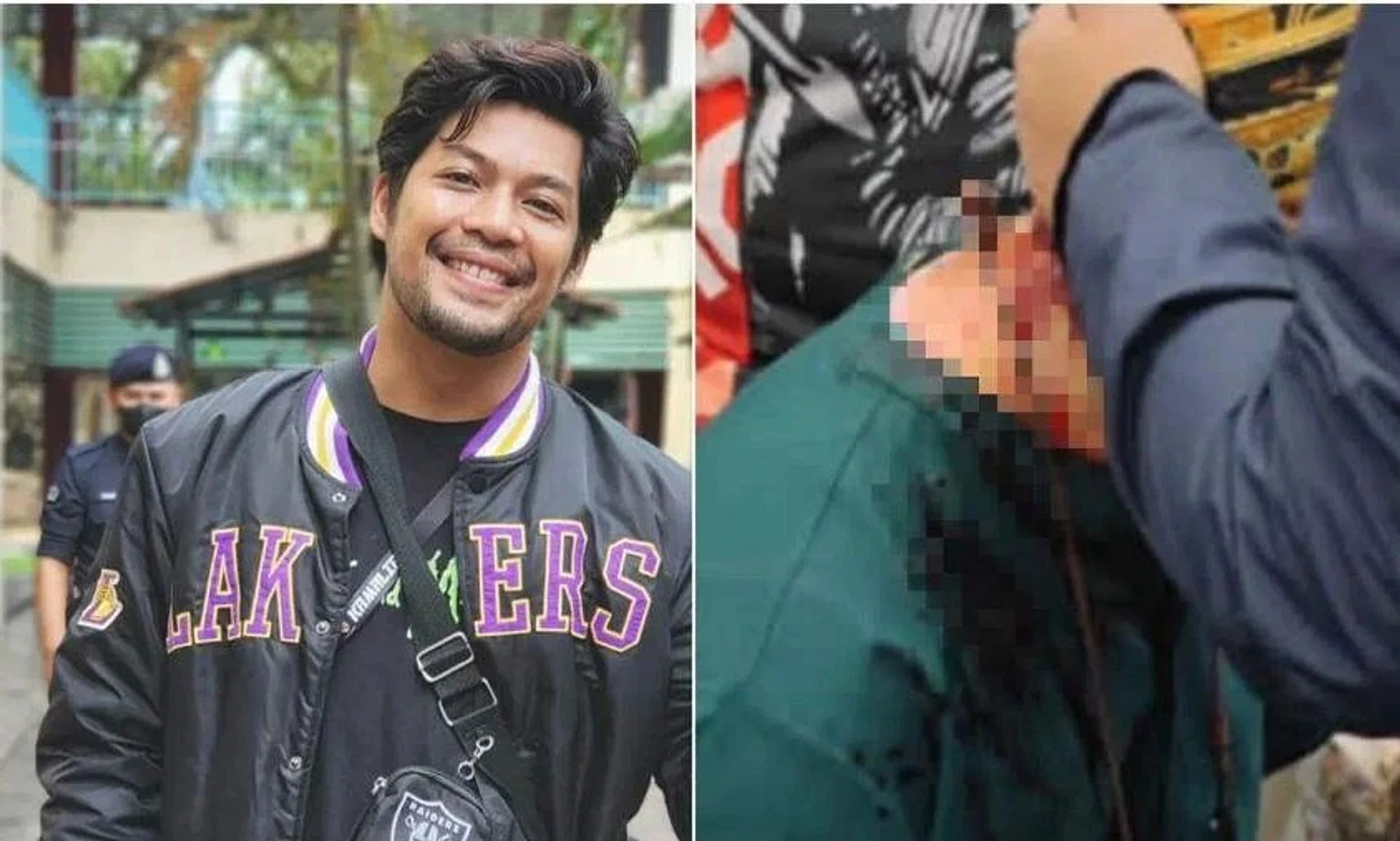 Malaysian actor Kamal Adli was rushed to Changi General Hospital and received stitches.