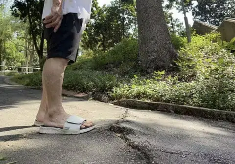 Jogger, 61, fractures shoulder after tripping in park