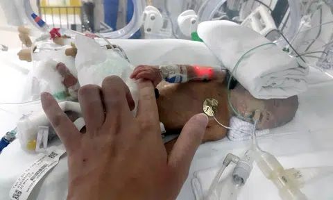 Parents of twins with rare condition: We can't hold our babies