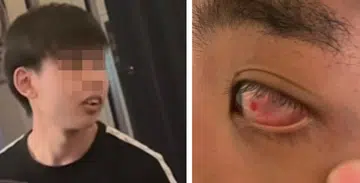Student claims he was punched in the eye at Chijmes