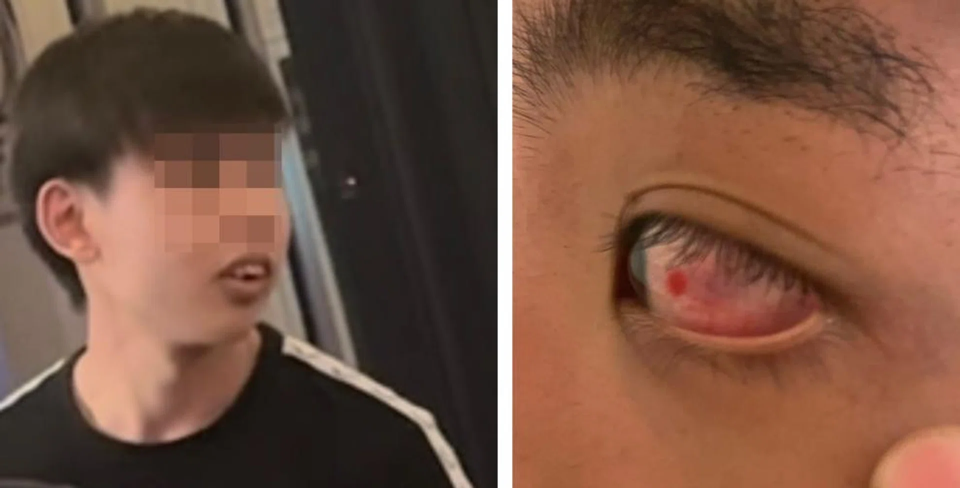 Mr He claims the bar employee hit him in the eye.