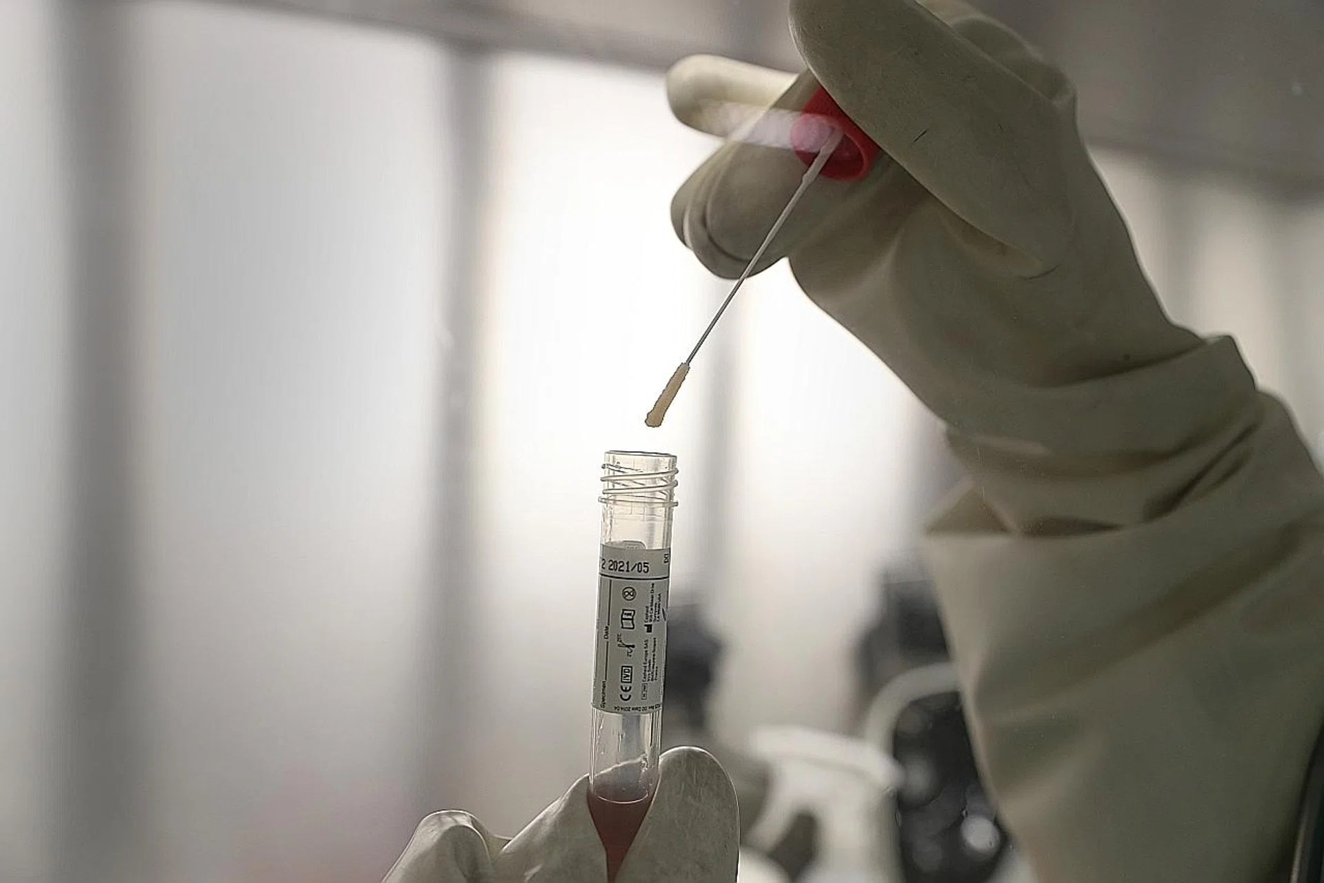 Antigen rapid testing is cheaper and yields quick results compared with the polymerase chain reaction test, where results can take up to two days. TNP FILE PHOTO