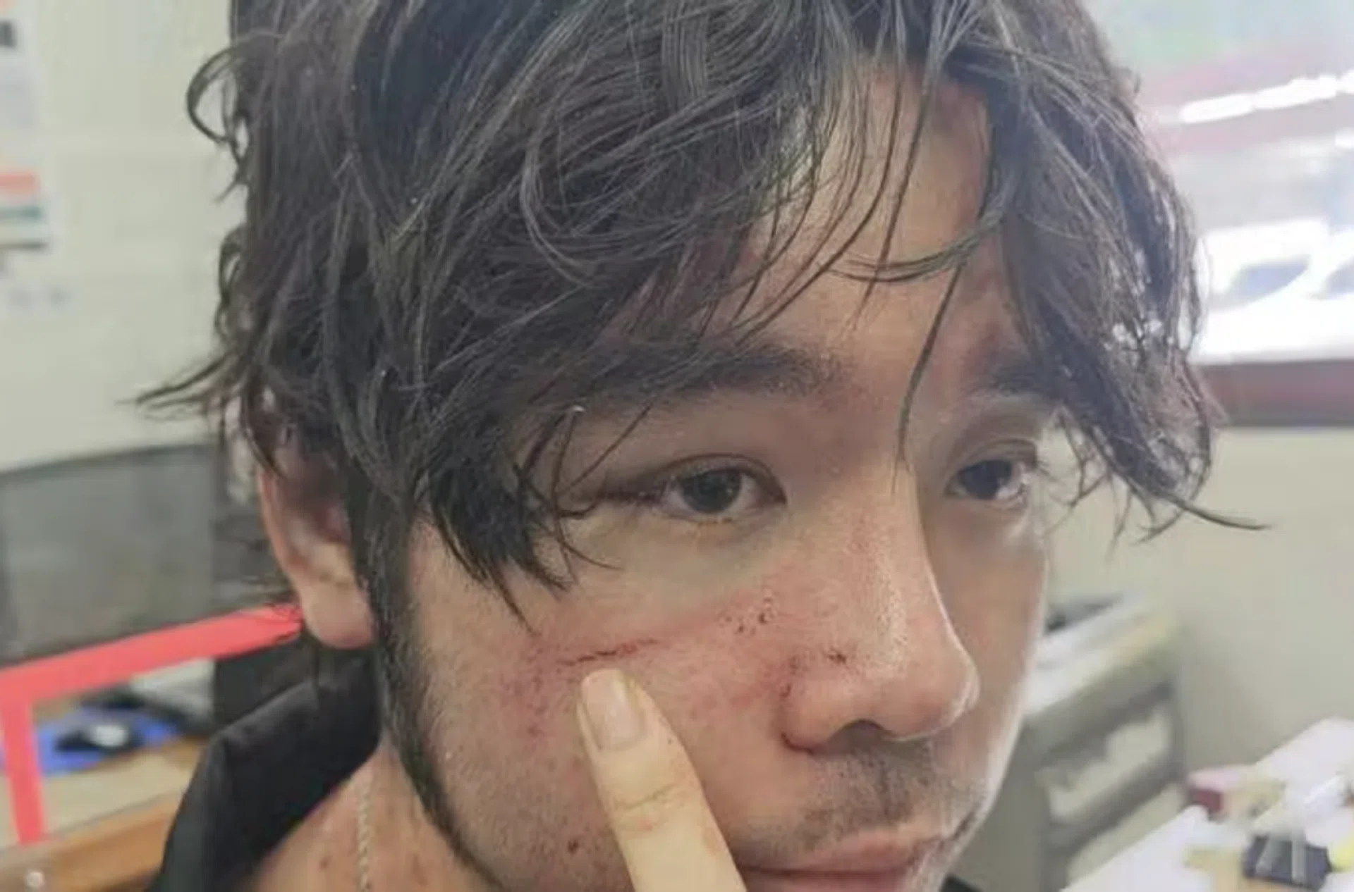 Kittisak Boonsan sustained bruises to his face as a result of the alleged assault.
