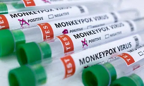 Three more cases of monkeypox detected in Singapore, bringing total to 19