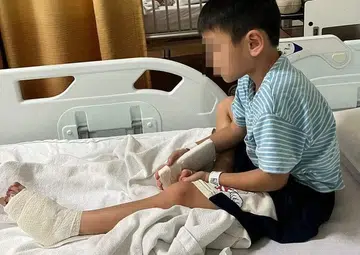 Boy, 6, undergoes surgery after toe gets caught in MRT station escalator