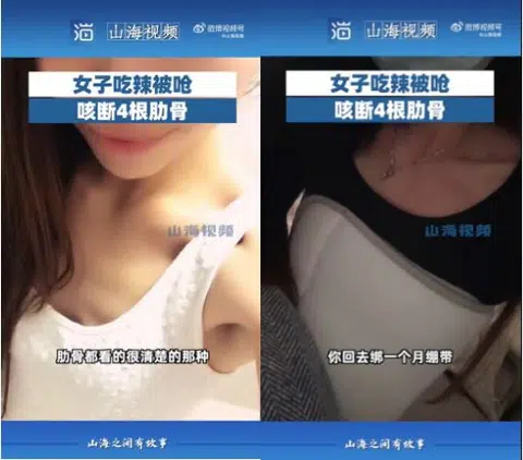 Woman has spicy dinner, ends up with broken ribs