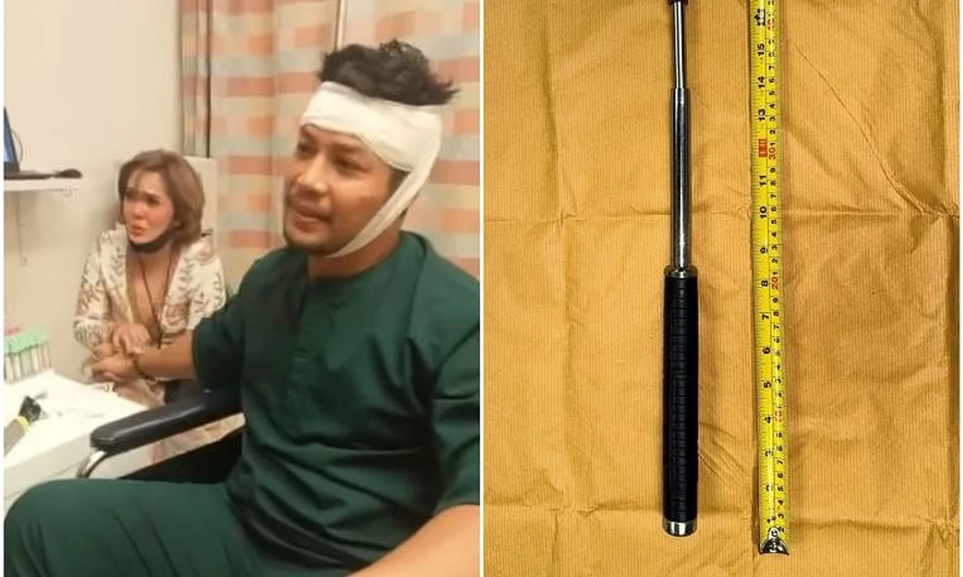 Malaysian actor Kamal Adli, seen with his wife, actress Uqasha Senrose, was rushed to Changi General Hospital and received four stitches after he was attacked by a man with a baton (right). 