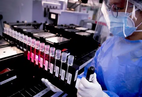 Labs here working at over 80% capacity as number of Covid tests jumps