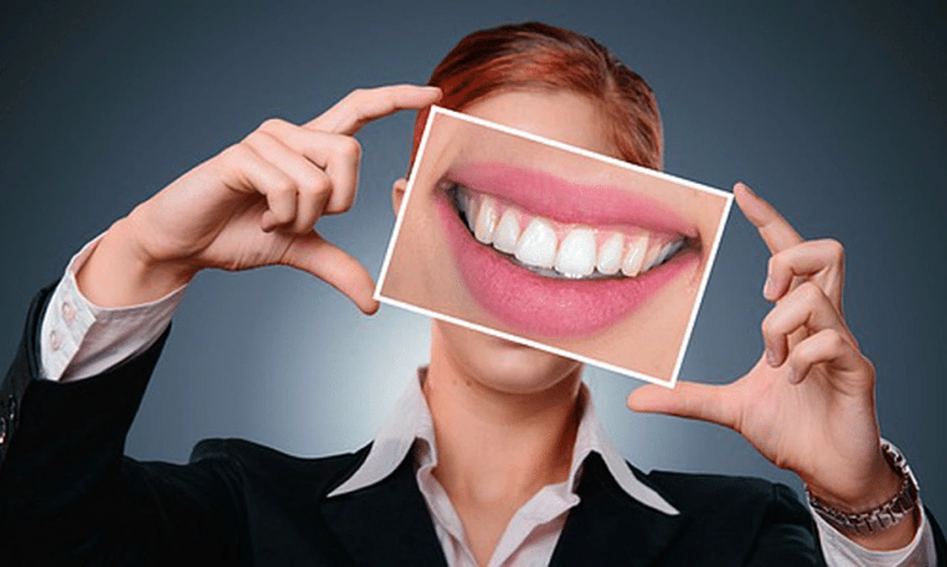 Teeth whitening or straightening products some influencers are promoting can be dangerous if used incorrectly.