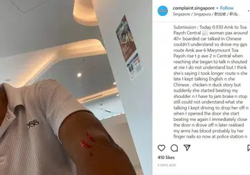 Woman assaults, scratches driver for supposedly 'taking longer route'