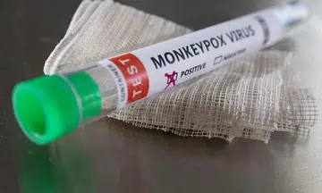 13th monkeypox case reported in S'pore; 34-year-old man is a local unlinked case