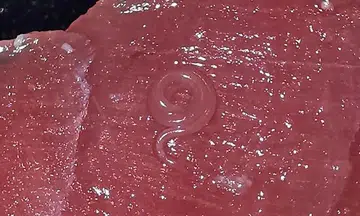 How common are parasites and bugs in our food?