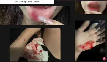 Woman trying to take drunk friend home allegedly punched repeatedly