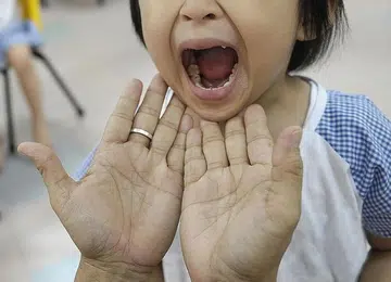 Hand, foot and mouth disease: What you need to know