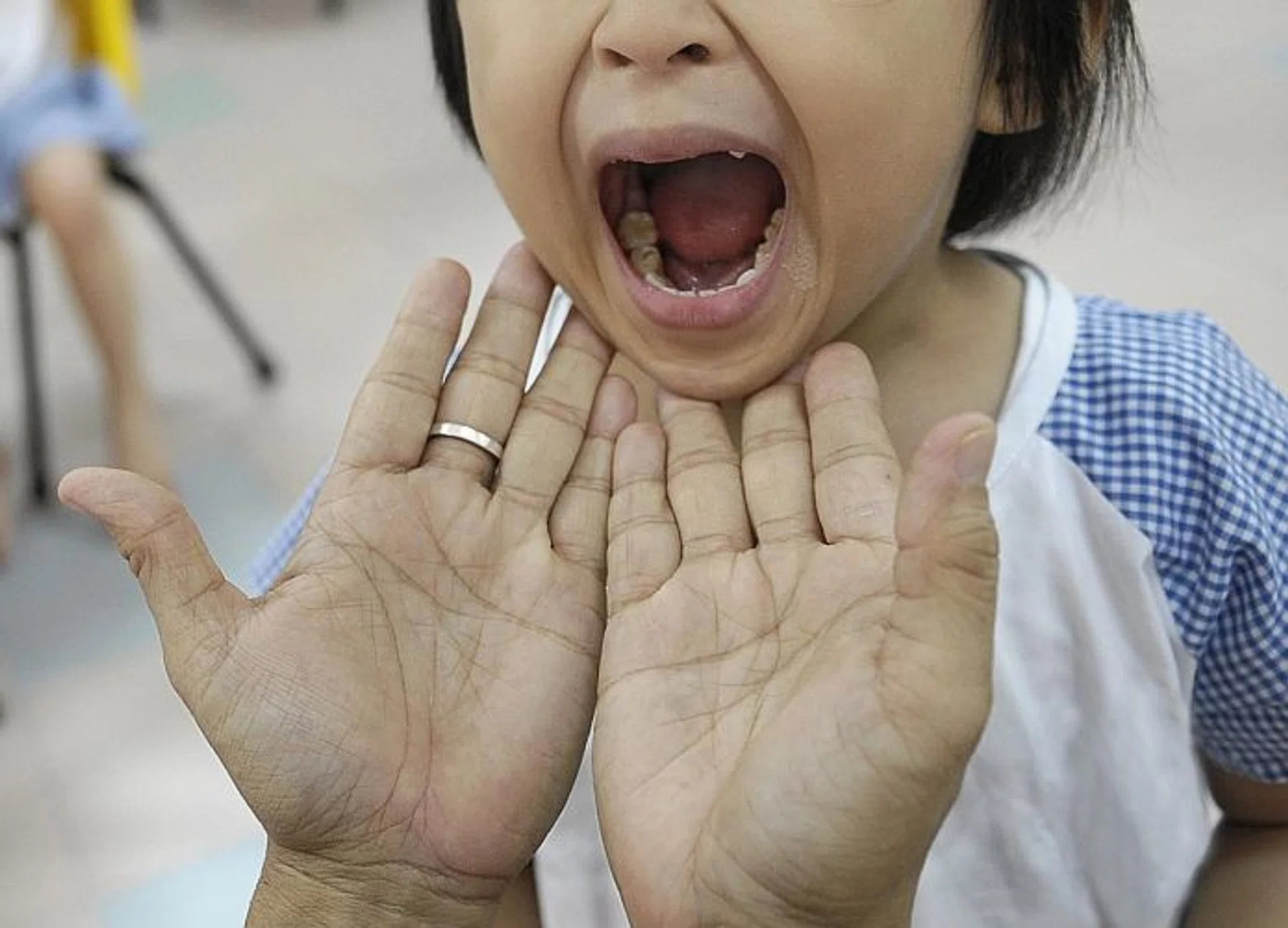 CAREFUL: A child getting her mouth checked.