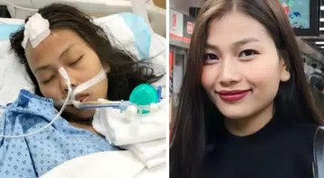 Maid hospitalised for brain inflammation suffers a stroke