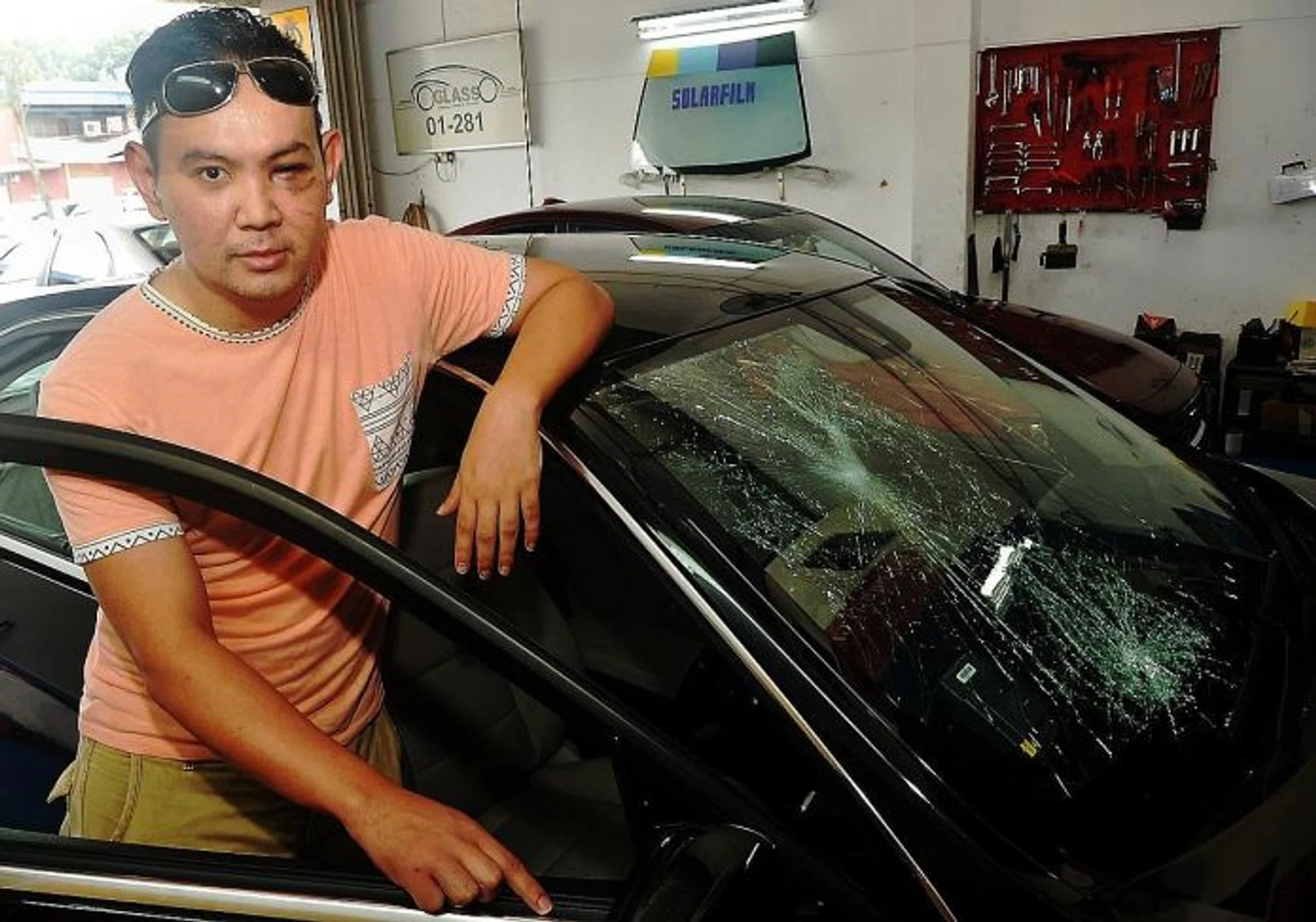 HURT: Mr Herman Zaidin was attacked and robbed by a group of men along the North-South Highway near Simpang Renggam in Johor on Sunday night.  