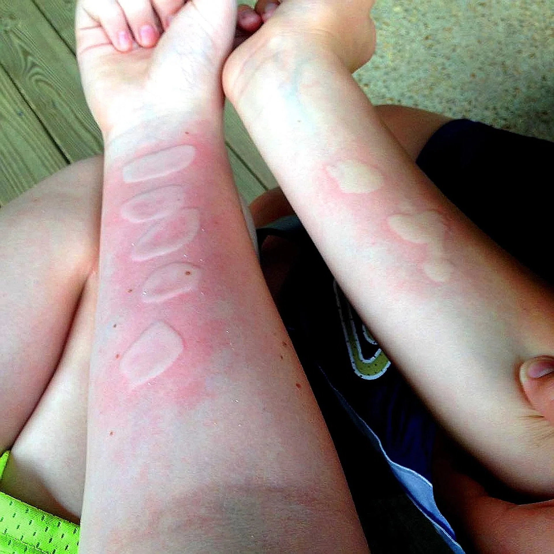 Results of the salt and ice challenge. 